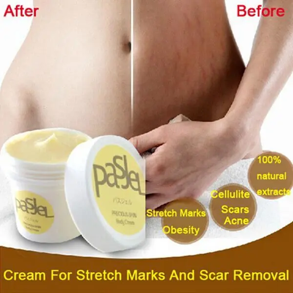 Scar Removal and Stretch Mark Cream