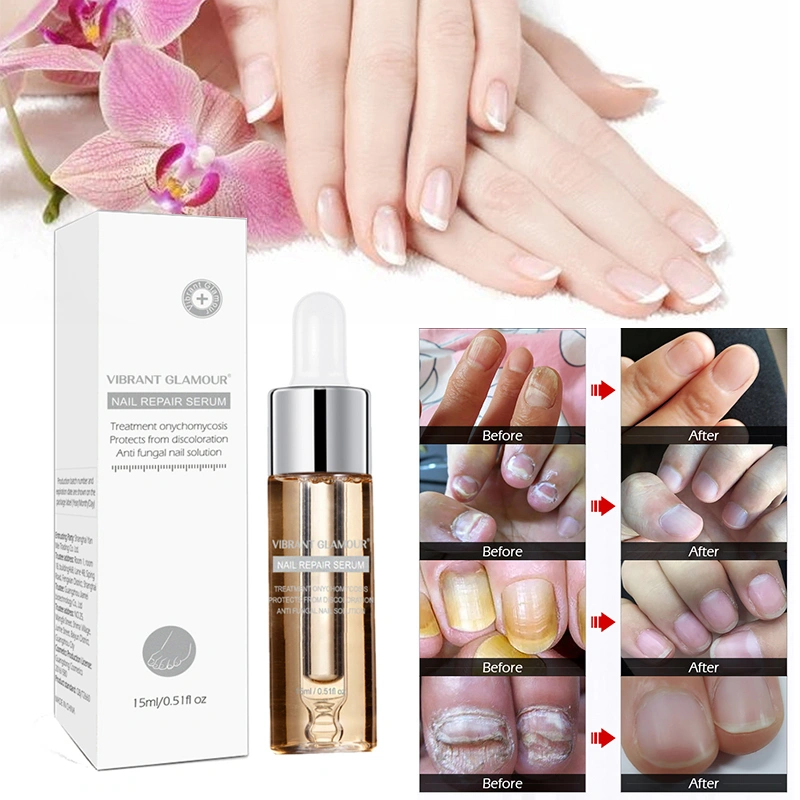 Nail repair and maintenance liquid