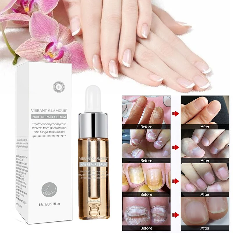 Nail repair and maintenance liquid