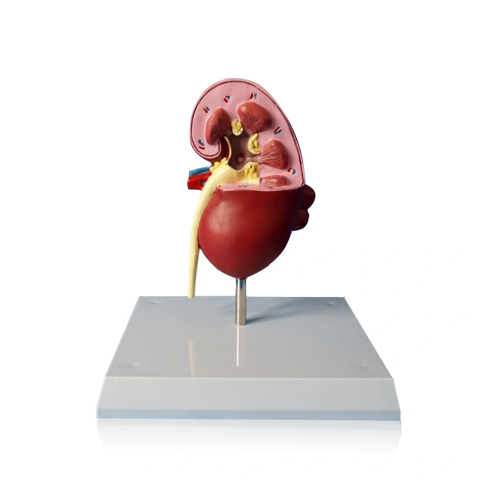 Anatomical Model Of Kidney Stone Pet Dog Lesion