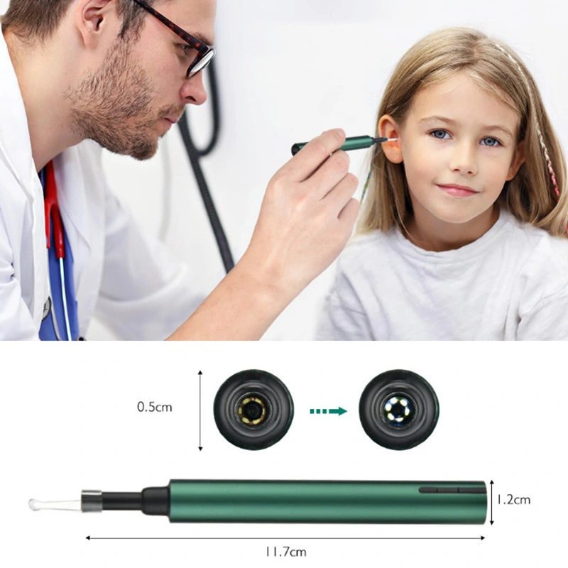 Smart WiFi Visual Ear Pick