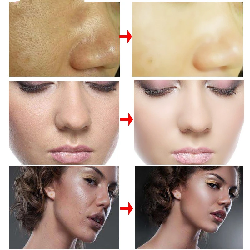 RtopR Cream RtopR001
