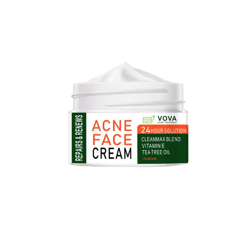 Acne Cream 30ml Is Easy To Use And Effective