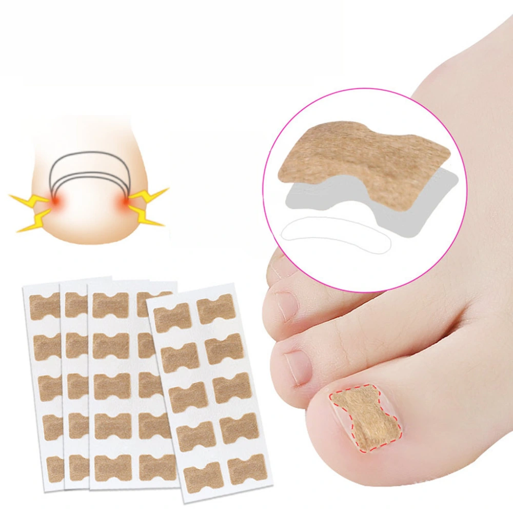 Orthodontic Nail Patch For Orthodontic Nail Correction