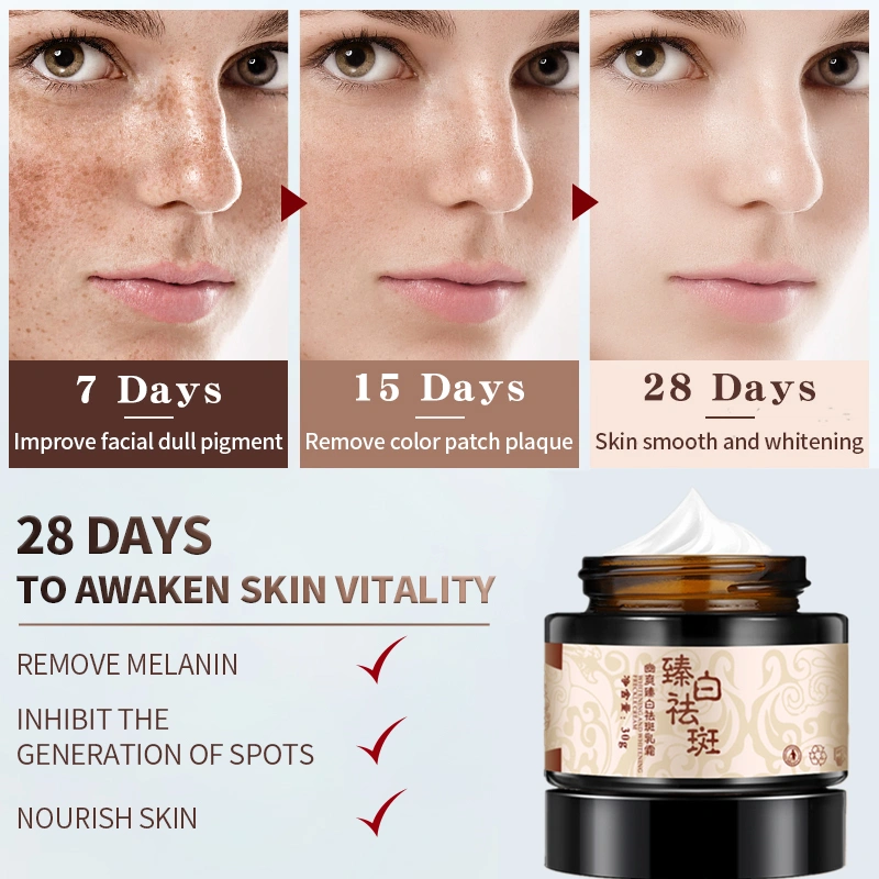 Whitening and freckle removing cream