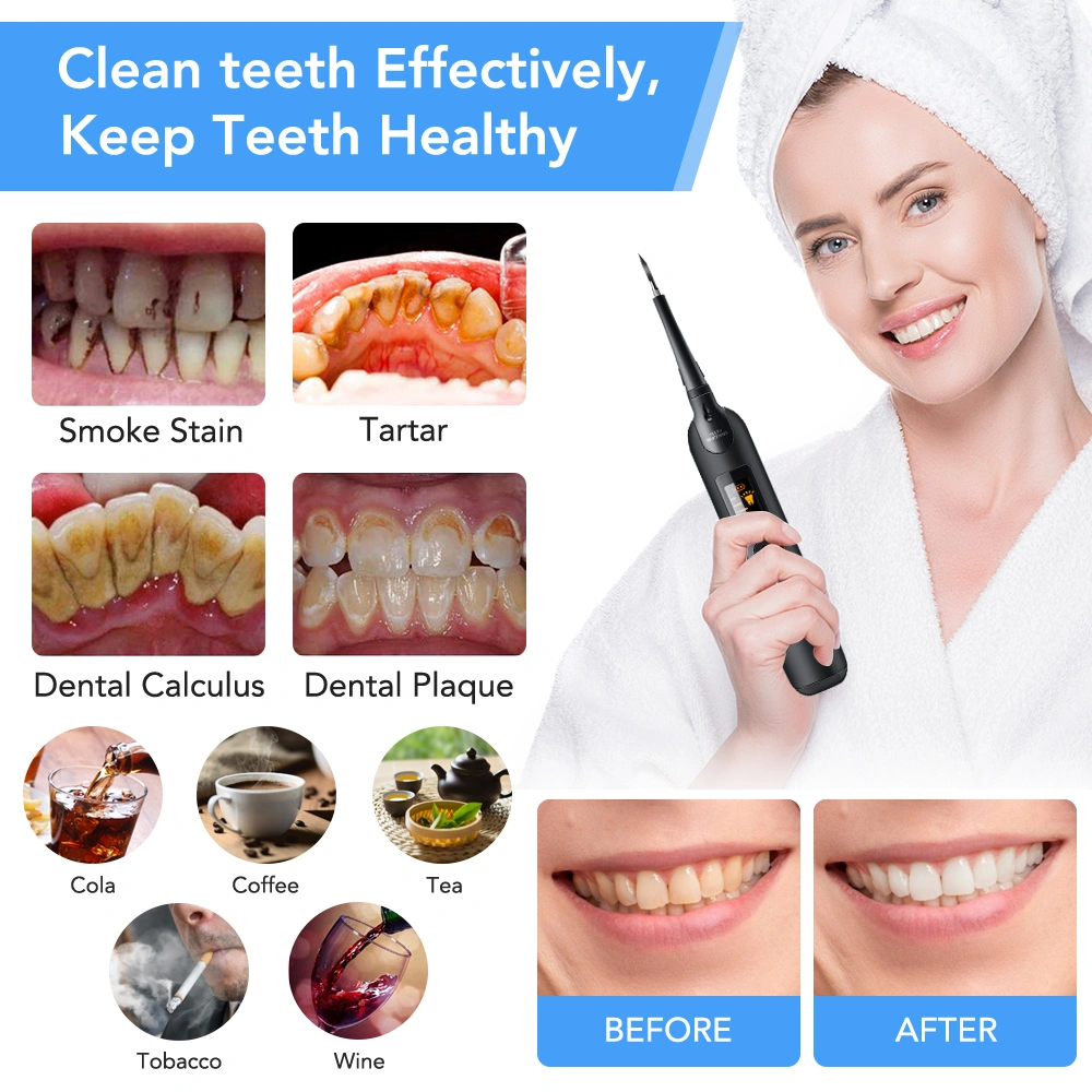 Household Portable Electric Dental Scaler