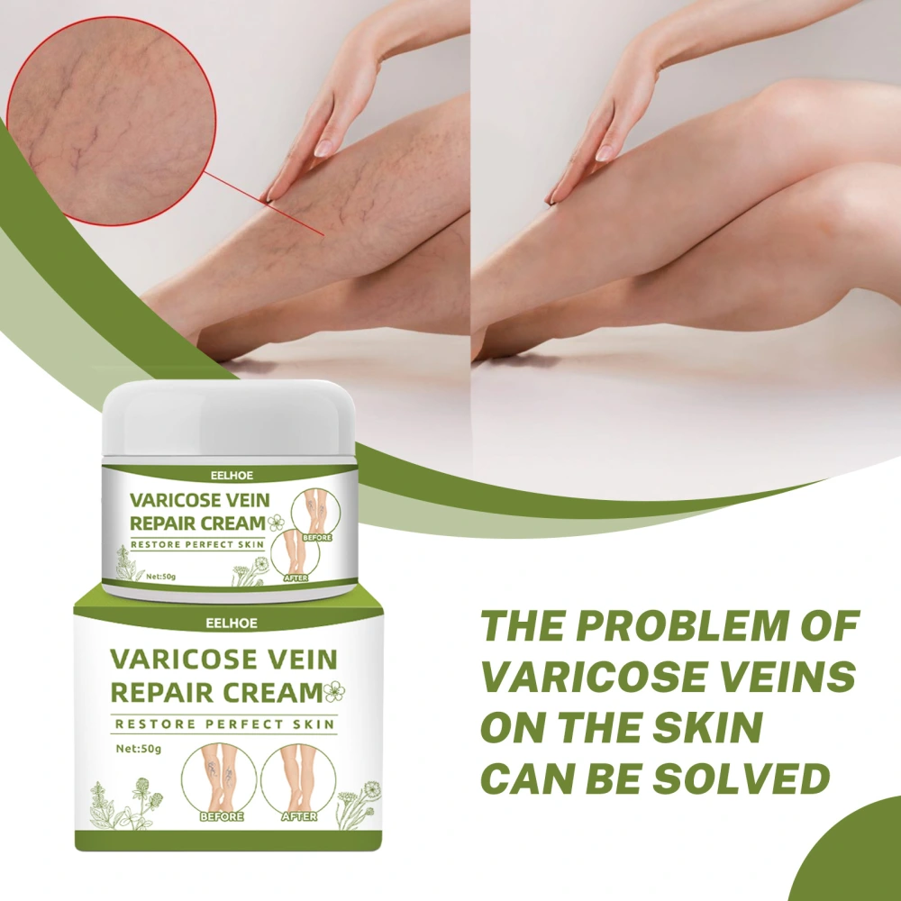 Intravenous Cream To Dredge The Veins And Relieve The Legs