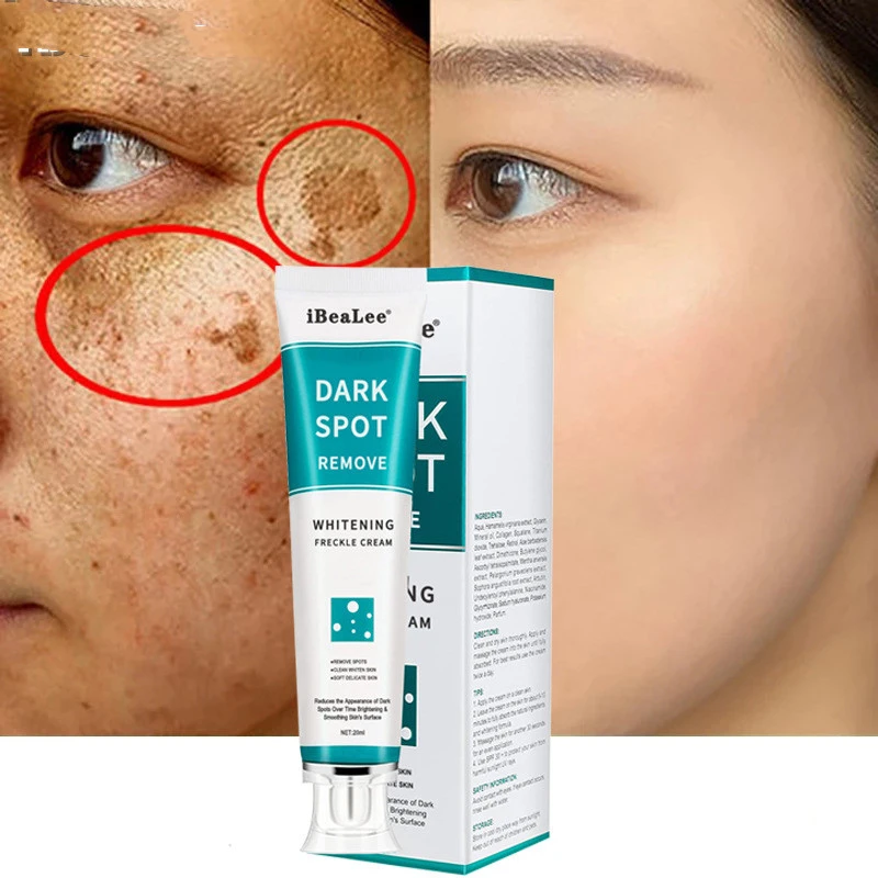 Whitening And Freckle Removing Cream Fade Spots Gently