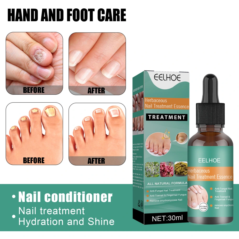 Home Bottled Nail Fungus Repair Lotion