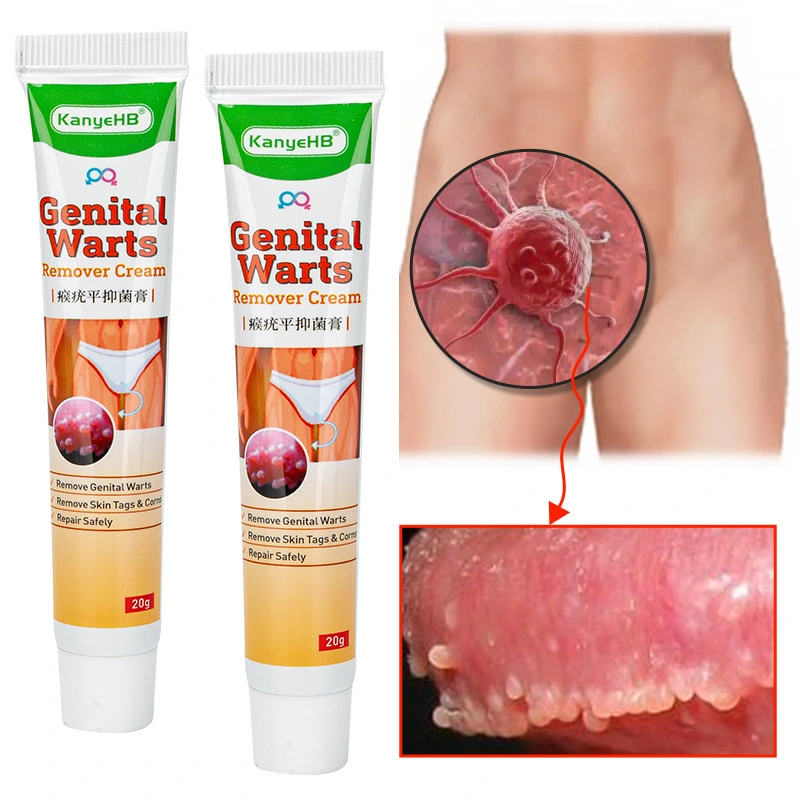 Pinghouyou Wart Remover Cream