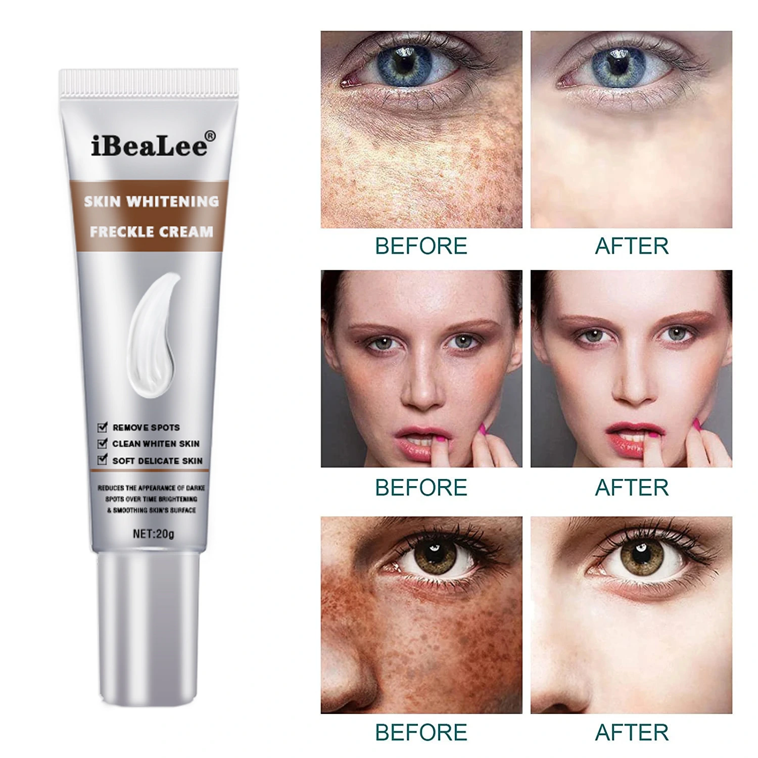 Mild Moisturizing And Improving Dark Yellow Freckle Removing Cream