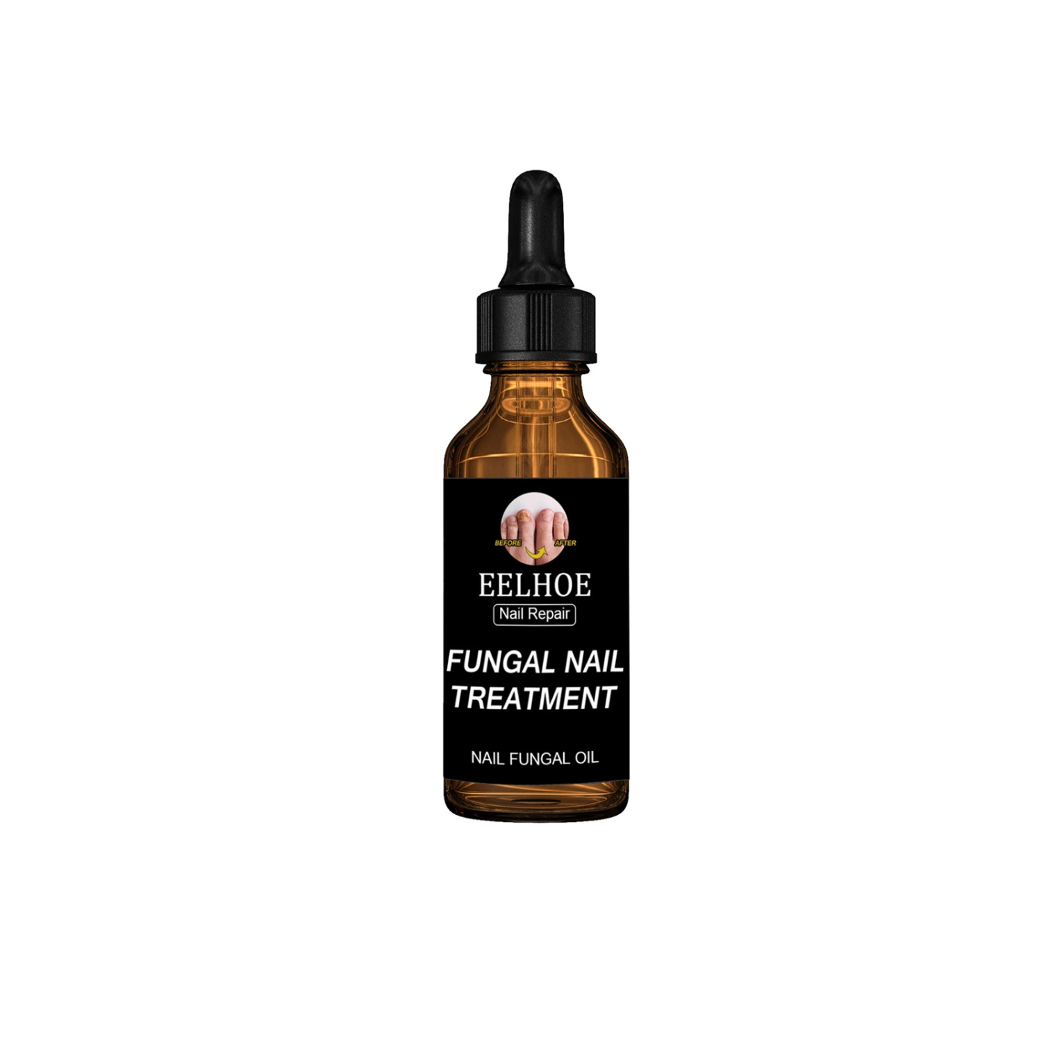 Onychomycosis Dead Skin And Repairing Lotion