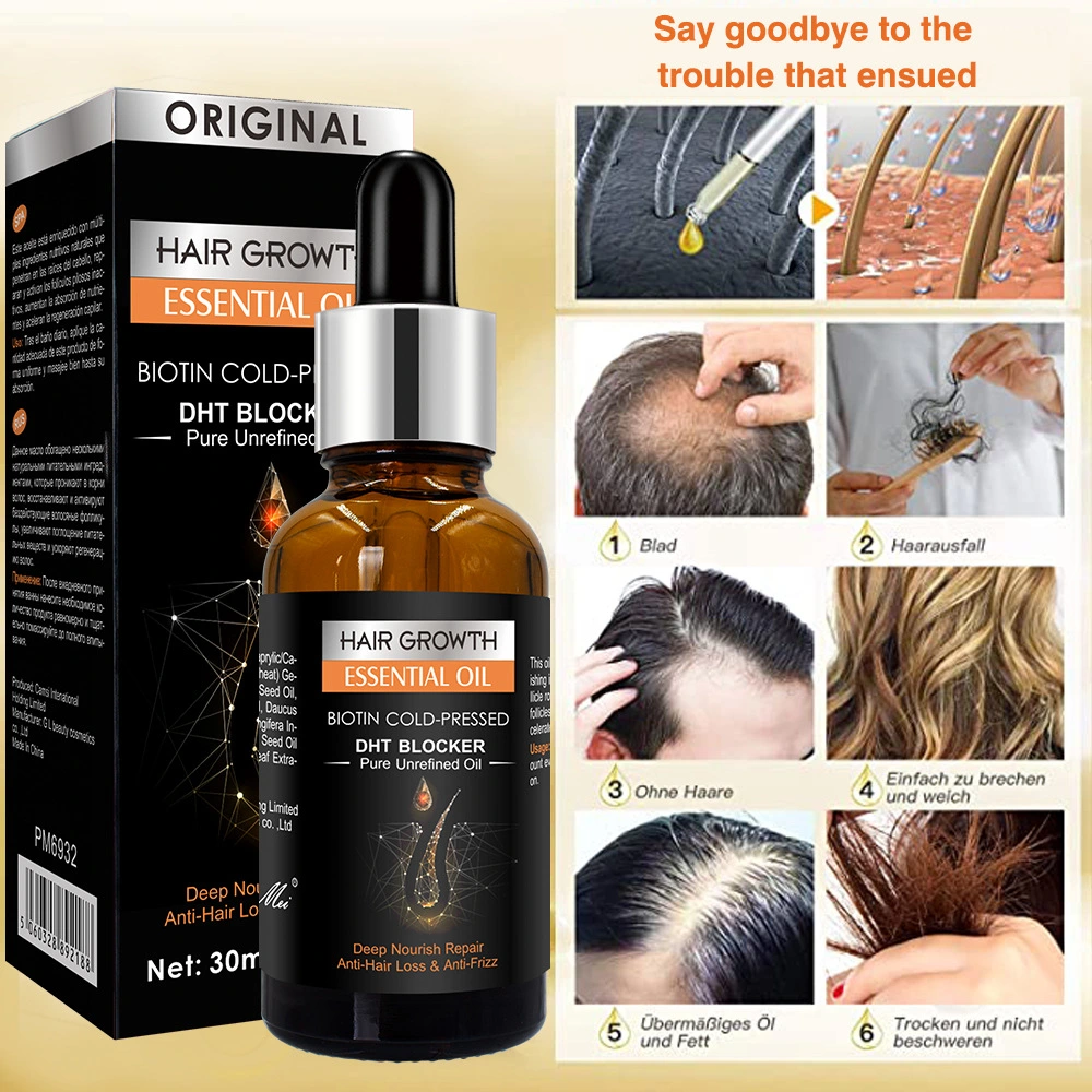 New Type Clean Dandruff Ginger Shampoo