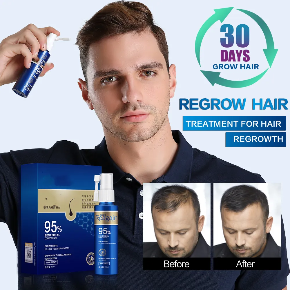 Hair Care Solution For Rapid Growth With Seborrheic Properties