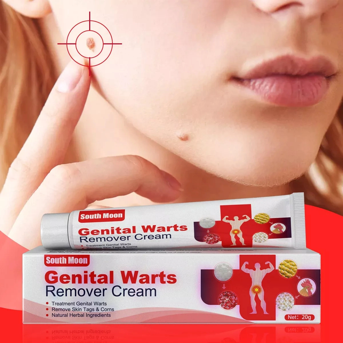 3PCS Skin Tags Wart Remover Condyloma Acuminatum