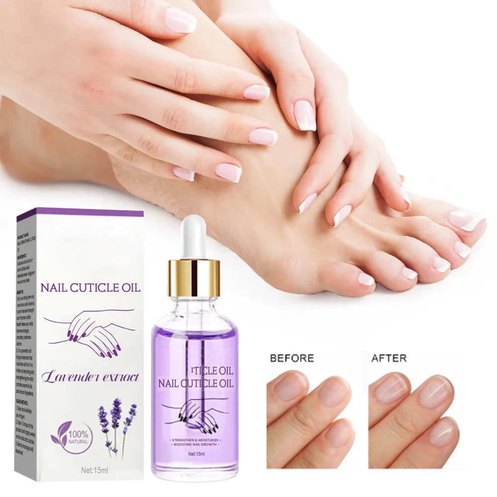 Nail Strengthening Cuticle Oil Repair Onychomycosis