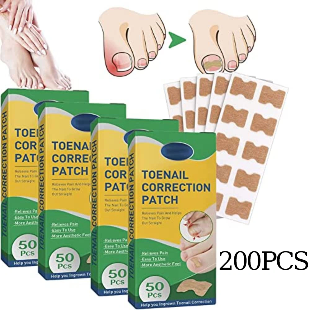 Ingrown Toenail Corrector,Fitmedify Nail Patches,Fit Toenail Patches,Ingrown Toenail Corrector Strips,Correction Patches for Toe Nails Fungus, Relieve Nail Groove