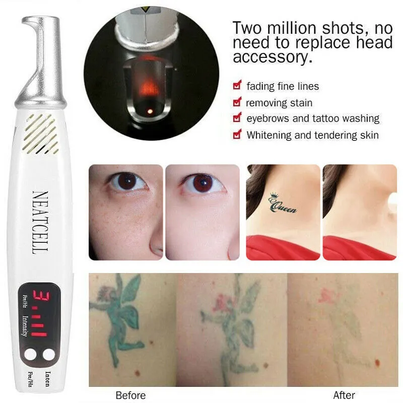 Tattoo Removal Pigment Prevention Spot Pen