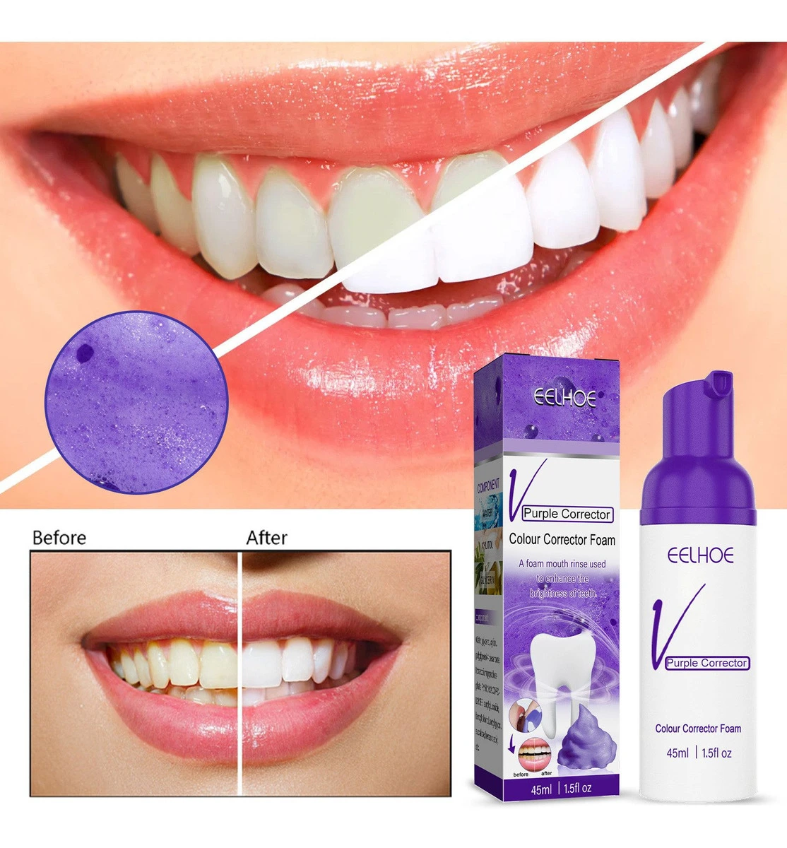 Tooth Whitening,Oral Care,Tooth Stain Removal