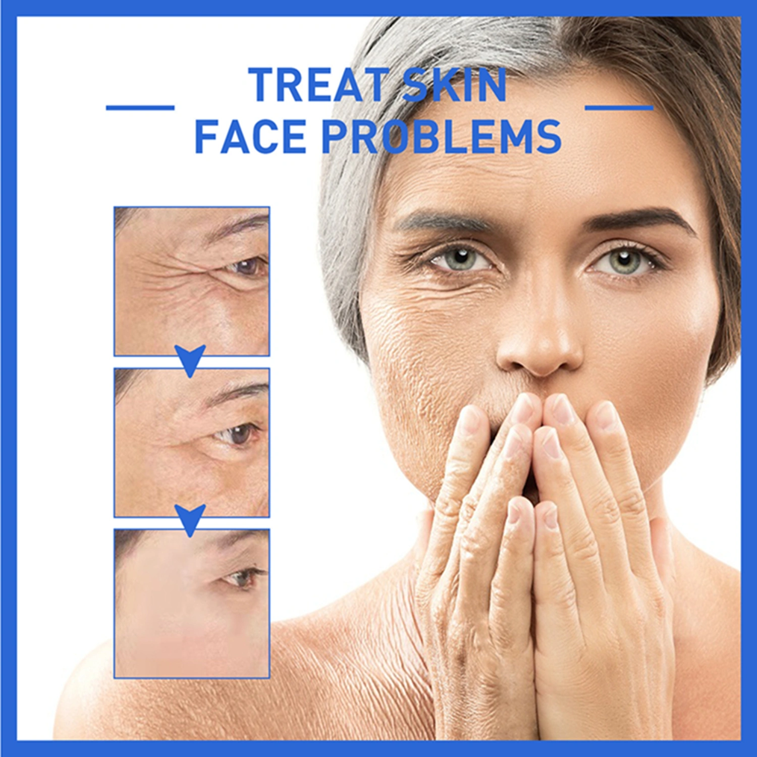 Botox Stock Solution Facial Cream, Youthfully Botox Face Cream, Anti Aging Cream, Botox Anti-Wrinkle Cream