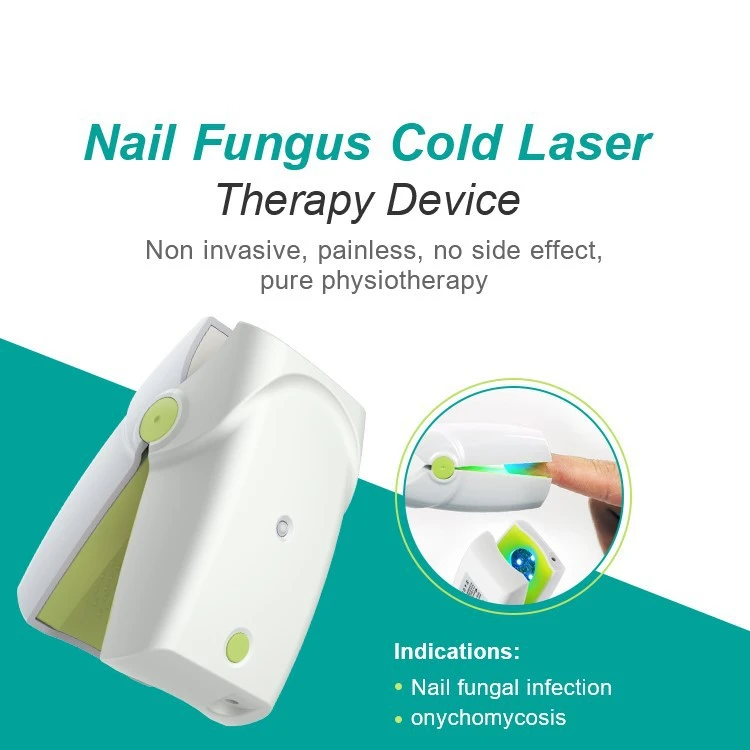 Blue Light Pulse Laser Nail Fungus Cleaning