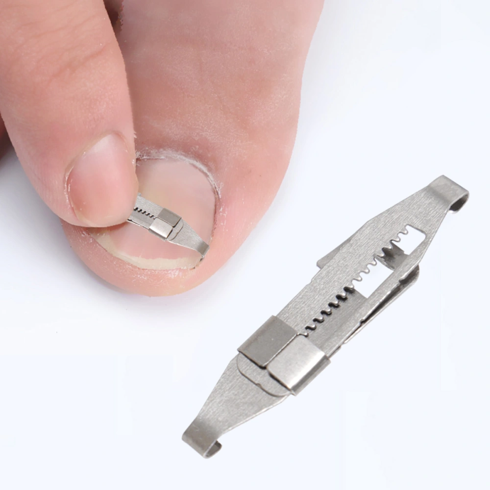 Stainless Steel Toenails Correction Buckles Straightening Clip Nail Patch Tool