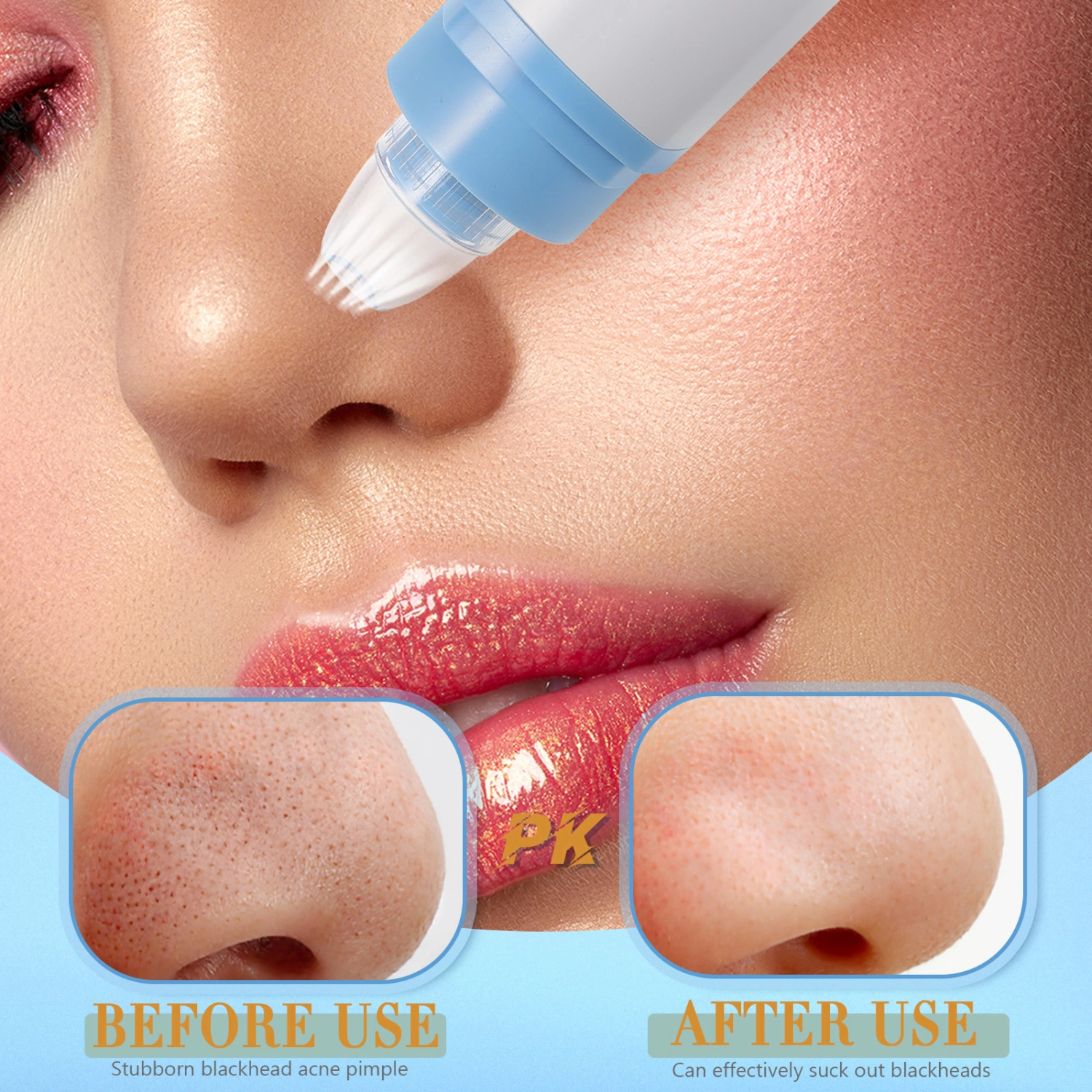 1 Set of Professional Blackhead Remover Household Pore Remover Convenient Pore Cleaner