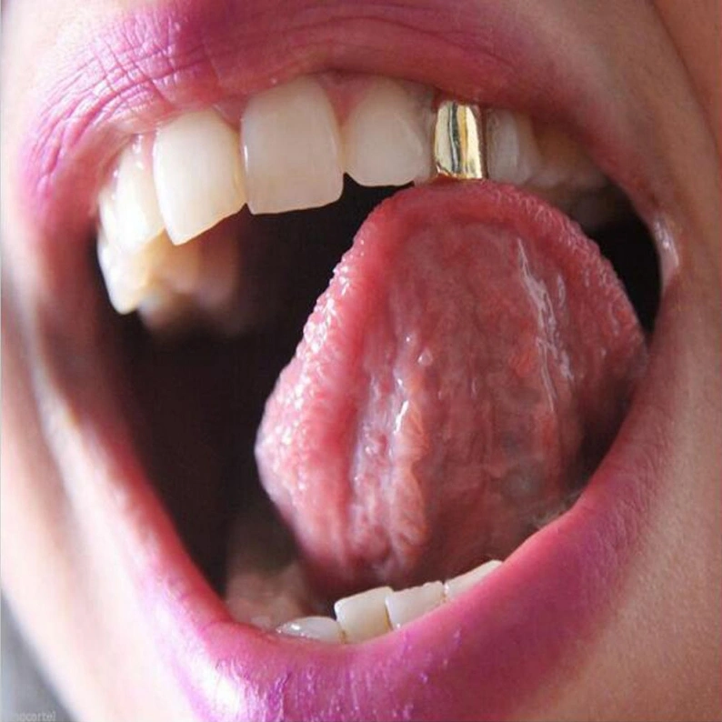 HIPHOP Gold-plated Single Tooth Socket