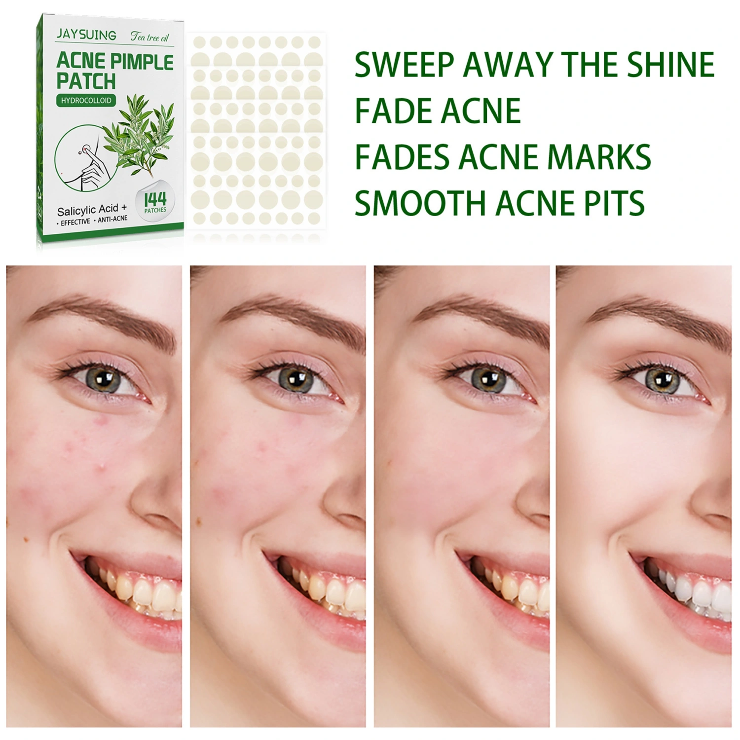 Pimple Patches for Face with Tea Tree Oil 144 PCS Acne Pimple Patch Invisible Acne Pimple Patches
