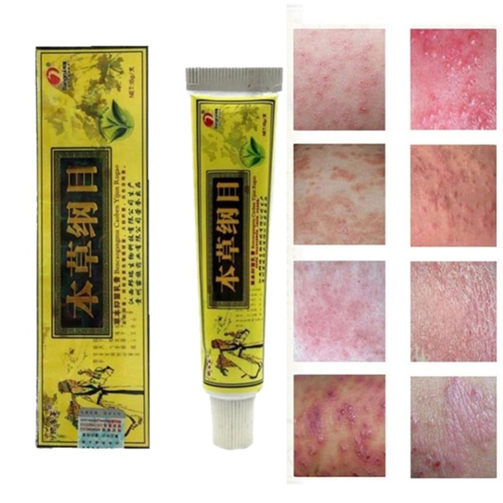 15ml Herbal Cream Psoriasis Dermatitis Eczema Pruritus Treatment Paste Ointment