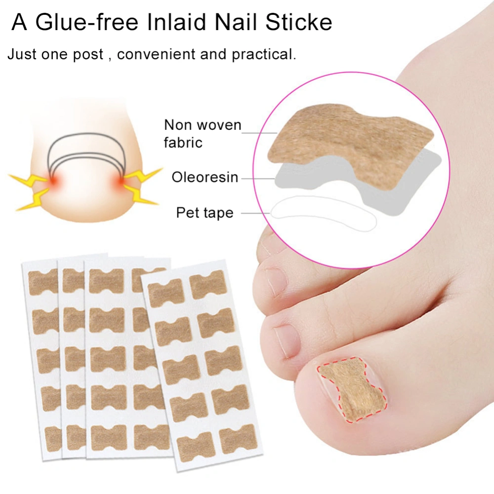 50Pcs Ingrown Toe Nail Correction Sticker Paronychia Foot Pedicure Corrector