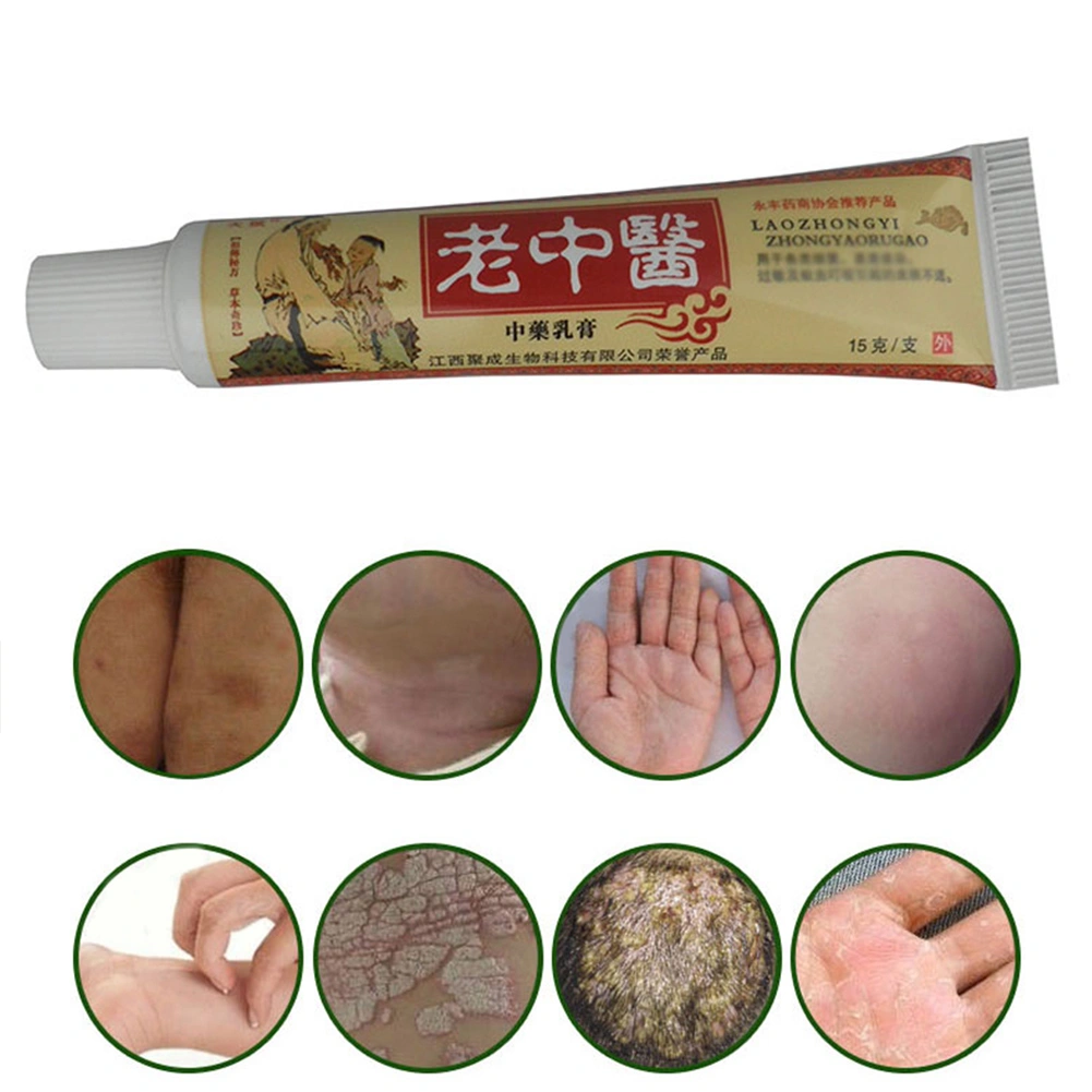 Chinese Herbal Medicine Relieve Itching Anti-Itch Cream Ointment Skin Care