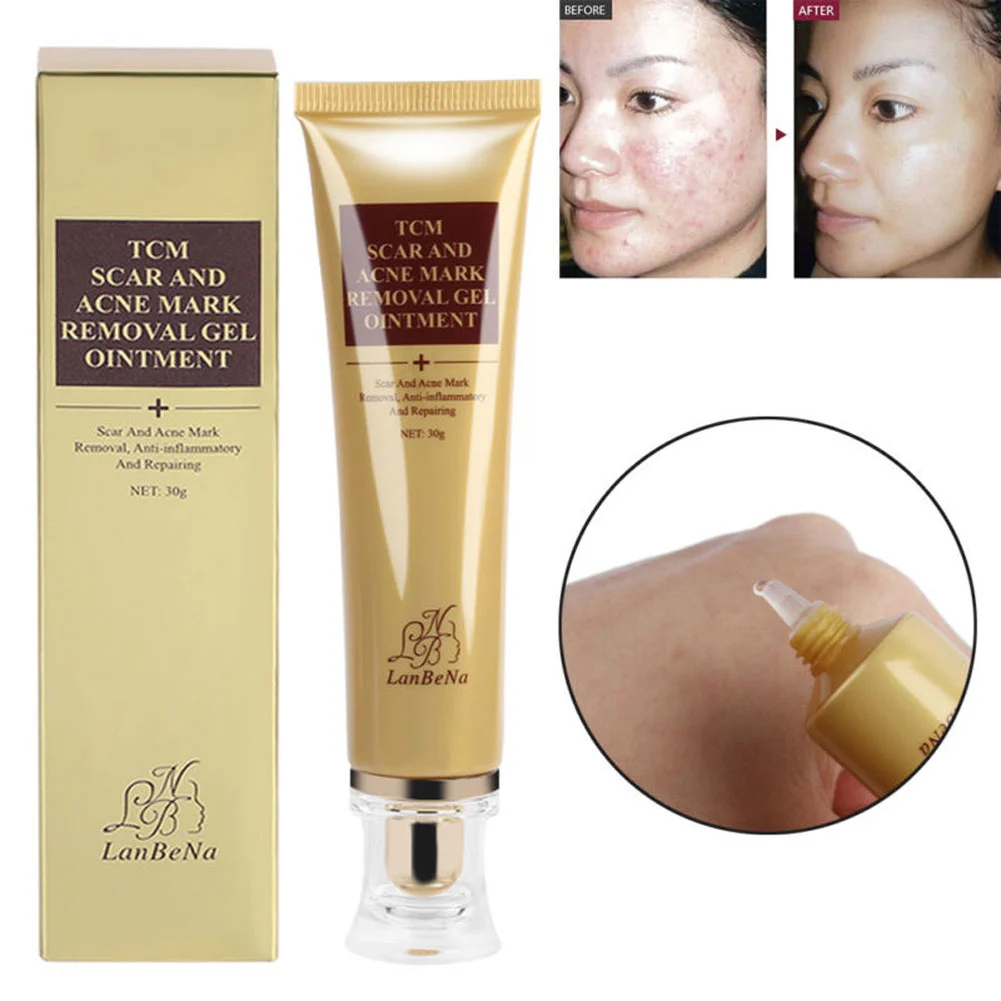 30g Scar Acne Mark Removal Wound Repair Skin Care Treatment Cream Ointment