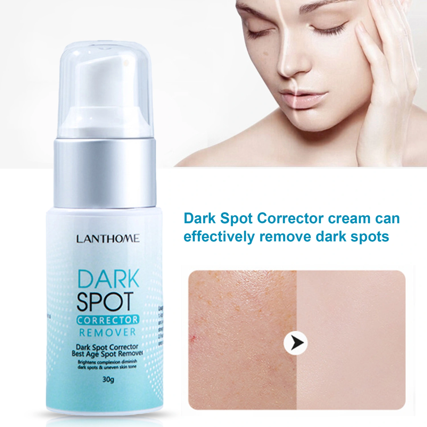 30g Dark Spot Cream Anti-wrinkles Repair Tissue Damage Not Irritating Skin Corrector Blemish Removal Cream for Girl