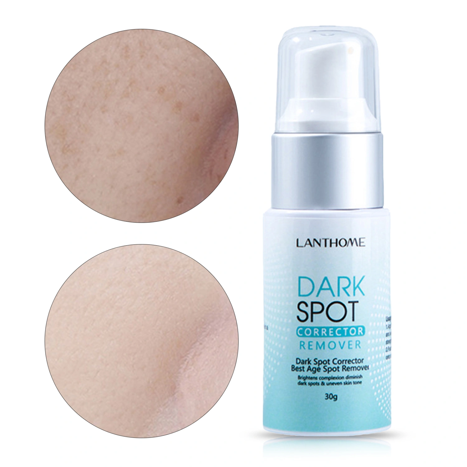 30g Dark Spot Cream Anti-wrinkles Repair Tissue Damage Not Irritating Skin Corrector Blemish Removal Cream for Girl