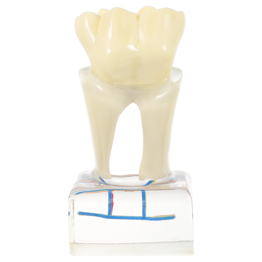 1 Pc Teeth Model Dental 6 Times Study Analysis Demonstration Teeth Model