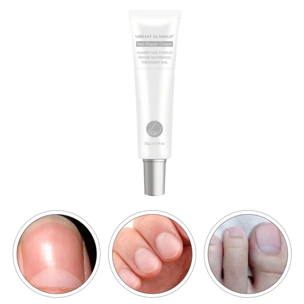 1pc Onychomycosis Ointment Finger Treatment Cream for Toenail Treatment