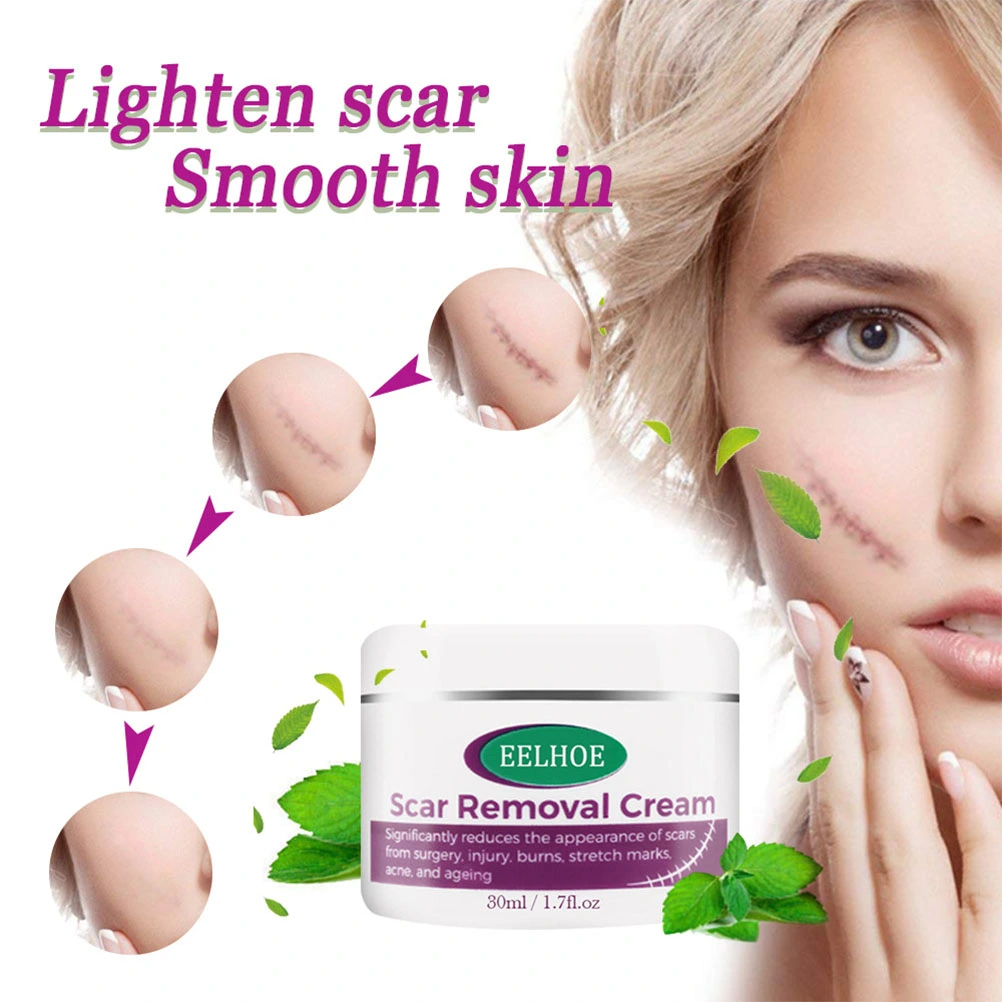 2pcs 30ML Remove Scar Cream Remove Scar Remove Striae Stretch Mark Corrector