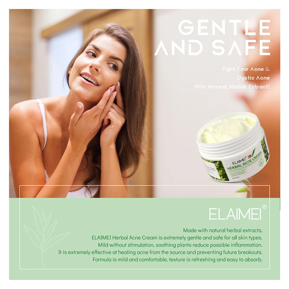 1 Bottle Acne Treatment Cream Anti-Aging Face Cream Natural Acne Cream