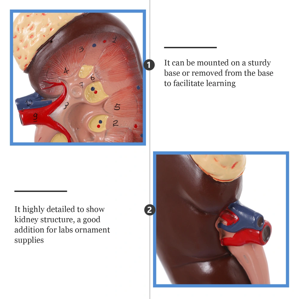 Medical Kidney Model 2X Enlarge Lesion Kidney Anatomy Medical Teaching Instrument