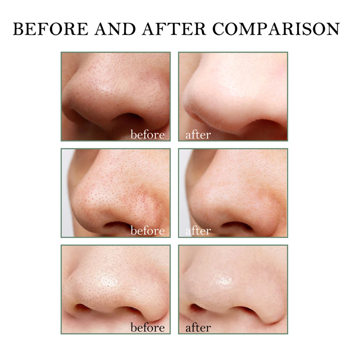 Deep Cleansing Blackhead Pore Strips,Blackhead Pore Strips Blackhead Facial Blemish and Blackhead Remover Tools