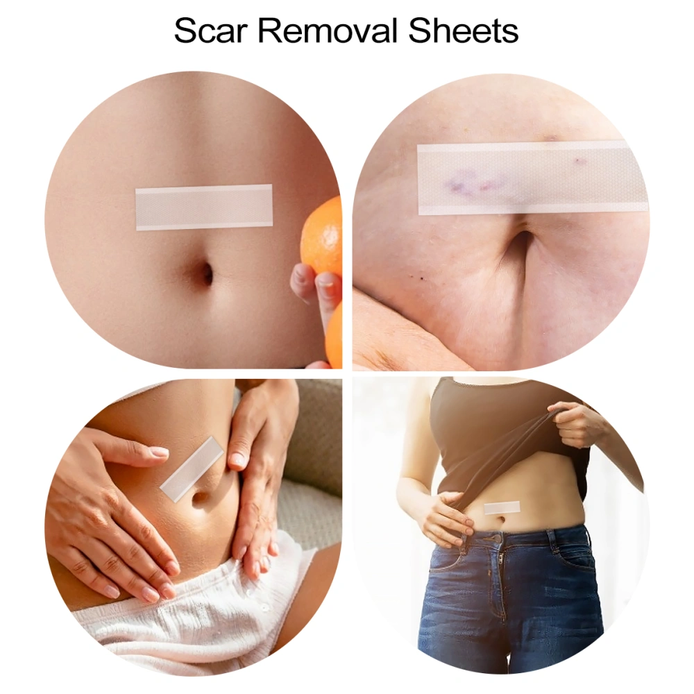 Silicone Gel Treatment Sheets Scar Stickers Surgical Wound Repair Scar Sheet