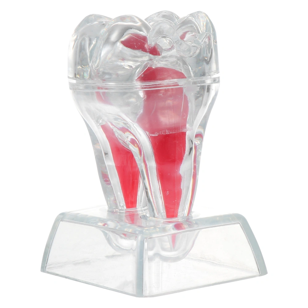 1pc Dental Implant Teeth Model Study Teach Model with Removable Teeth (Transparent color Red)