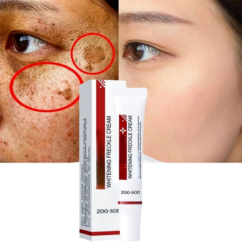 1pc, 20G Effective Whitening Freckle Cream, Remove Dark Spots Freckle Cream, Niacinamide Fade Pigmentation Melasma Brighten Creams