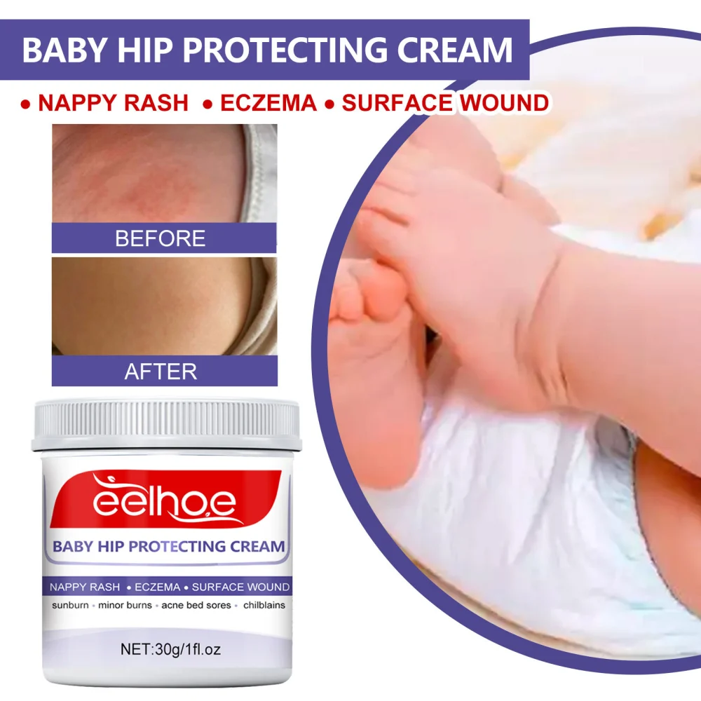 Baby Hip Moisturizing Skin Repair Neck Cream