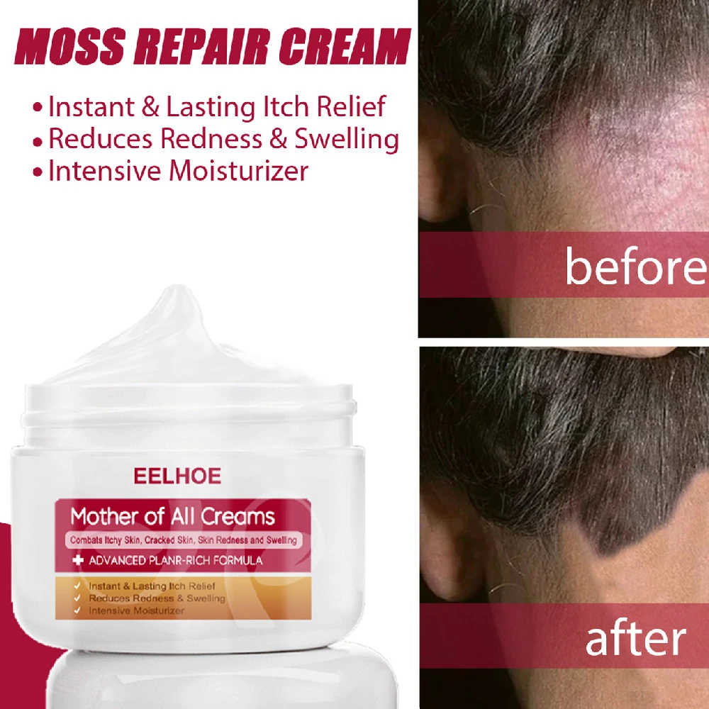 Skin Moss Repair Cream Relieve Itching And Relieve Itching Hydrating Moisturizing And Nourishing Skin