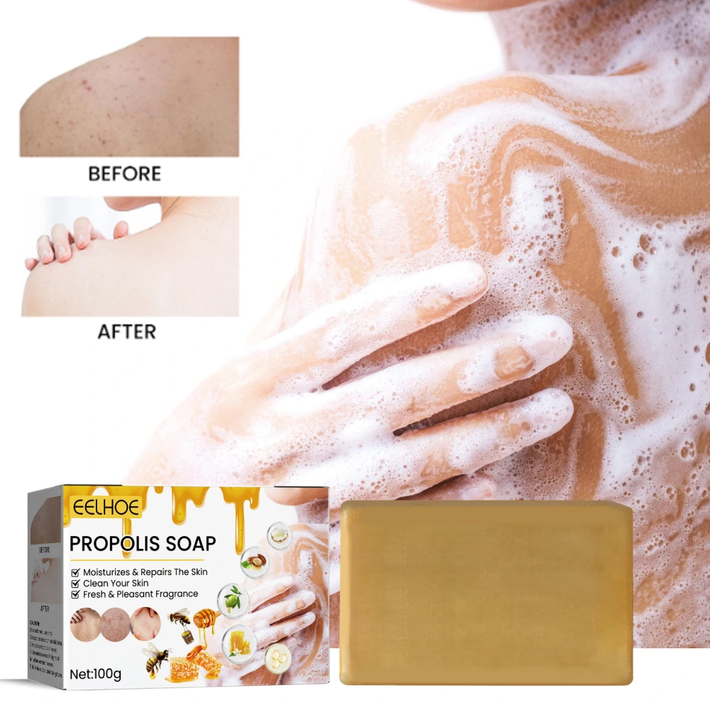 Deep Skin Cleaning Desalting PIMPLE Acne Tender And Smooth Skin Beauty Propolis Bath Soap