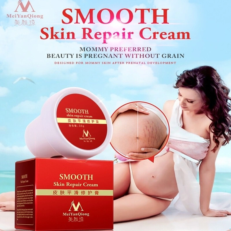 High Quality Smooth Skin Cream For Stretch Marks Scar Removal To Maternity Skin Repair Body Cre