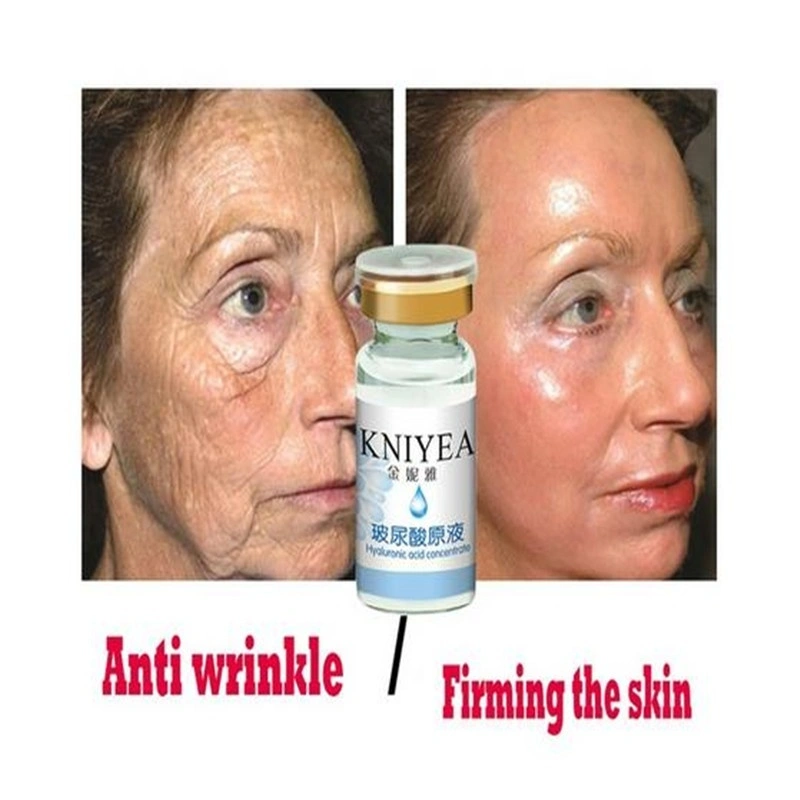 Stoste Hyaluronic acid collagen solution anti-wrinkle anti-aging moisturizing nourishment