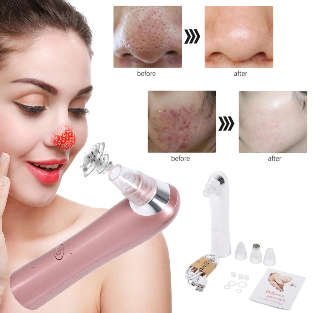 Electric Facial Skin Pore Cleaner Acne Nose Blackhead Suction Remover LQS(white)